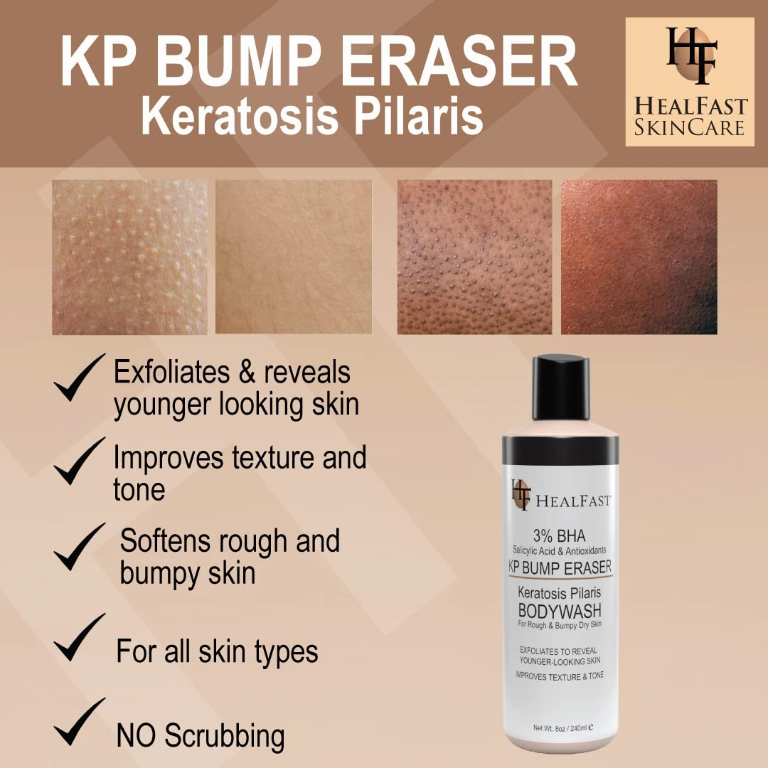 KP Bump Eraser Bodywash – Soften, Exfoliate, Nourish Rough and Bumpy Skin with 3% BHA – Keratosis Pilaris - For All Types – No Scrubbing Required – Fragrance and Paraben Free